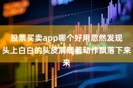 股票买卖app哪个好用忽然发现头上白白的头皮屑随着动作飘落下来